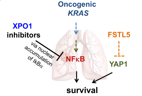 Pathway Illustrating XPO1 inhibitor on the KRAS NF-kappa B pathway in Lung Cancer