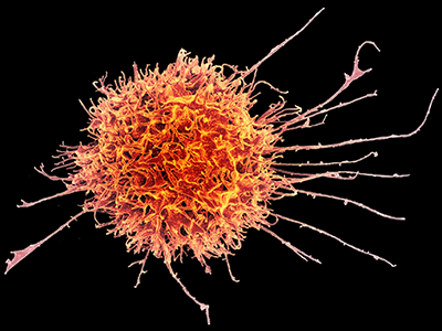 Colorized scanning electron micrograph of a natural killer cell from a human donor.