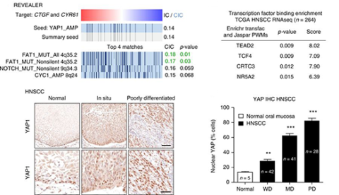 Frequent alterations of FAT1 are linked to YAP1 overactivity in cancer
