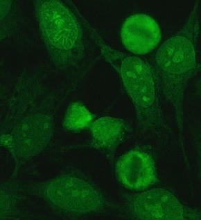 Immunofluorescence pattern of nucleolar and nuclear membranes. Image by Simon Caulton via Wikimedia Commons. 
