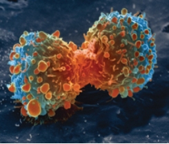 Cancer cells dividing