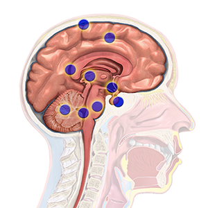 Brain Cancer Regions