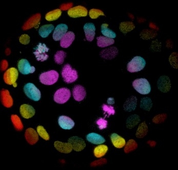 Colorectal Cells Grown into Organoids