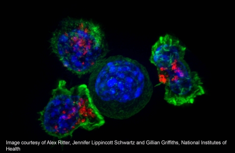 T-cells surrounding a tumor cell