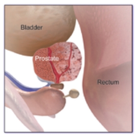 Anatomical Image of prostate gland  