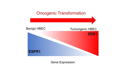 Increased ZEB1 expression promotes ocogenic transformation.
