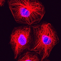 Breast cancer cells. Cytoskeletal proteins are shown in red and DNA is shown in blue. Source: Lutz Langbein, German Cancer Research Center via Medical Xpress.