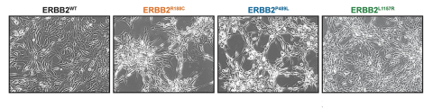  Stable expression of ERBB2 mutants in NIH 3T3 fibroblasts exhibited spontaneous foci formation in monolayers independent of cell plating density
