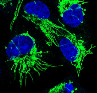 Ras-Driven Cancer