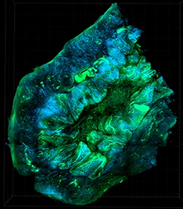 Ovarian Tumor Microenvironment