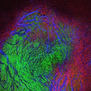 Tumor-Associated Macrophages with Fluorescent Nanoparticles