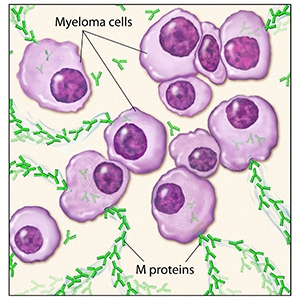 Myeloma Cells
